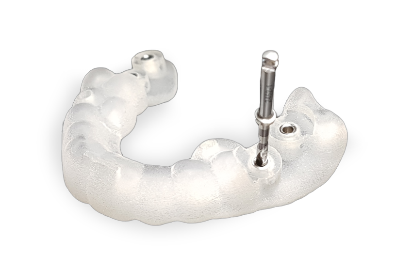 Gouttière Biotech Dental